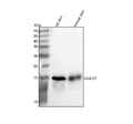 Western blot analysis of Galectin-7/LGALS7 using anti-LGALS7/7B antibody. Lane 1: rat skin tissue lysates, Lane 2: mouse skin tissue lysates. After electrophoresis, proteins were transferred to a nitrocellulose membrane at 150 mA for 50-90 min. Blocked the membrane with 5% non-fat milk/TBS for 1.5 hour at RT.