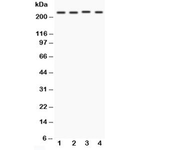 Western blot testing of NOTCH1 antibody and Lane 1: MCF-7; 2: HeLa; 3: Jurkat; 4: COLO320. Predicted molecular weight: ~ 270 kDa (full length), ~ 120 kDa (transmembrane fragment).