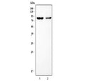 Western blot testing of 1) rat heart and 2) mouse heart tissue lysate with TEM8 antibody. Expected molecular weight: ~83 kDa (PA83) that is cleaved into ~63 kDa (PA63) and ~20 kDa (PA20) fragments.