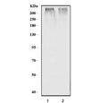 Western blot testing of 1) rat heart and 2) mouse heart tissue lysate with RYR2 antibody. Predicted molecular weight ~565 kDa.