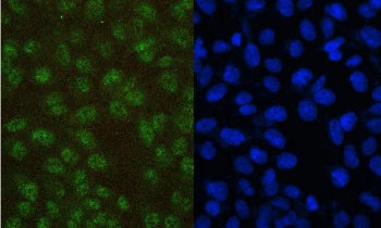 Immunofluorescent staining of FFPE human U-2 OS cells with PAX5 antibody (green) and DAPI (blue). HIER: boil tissue sections in pH6, 10mM citrate buffer, for 20 min and allow to cool before testing.