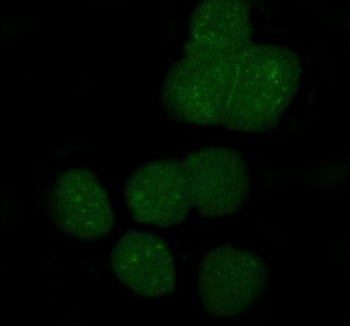 Immunofluorescent staining of FFPE human A431 cells with APOBEC3G antibody (green). HIER: steam section in pH6 citrate buffer for 20 min.