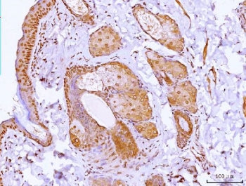 IHC staining of FFPE mouse skin tissue with HOXC12 antibody. HIER: boil tissue sections in pH8 EDTA for 20 min and allow to cool before testing.