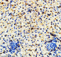 IHC staining of FFPE zebrafish liver tissue with Zebrafish Hmox1a antibody, HRP-labeled secondary and DAB substrate. HIER: boil tissue sections in pH8 EDTA for 20 min and allow to cool before testing.