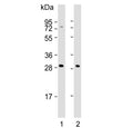 Western blot testing of human 1) K562 and 2) HepG2 cell lysate with NKG2A antibody. Predicted molecular weight: 26-40 kDa depending on glycosylation level.