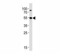 Western blot analysis of lysate from Jurkat cell line using AKT3 antibody at 1:1000. Predicted molecular weight: ~56kDa but can be observed from 60~65kDa.