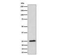 Western blot testing of human HeLa cell lysate with RPL10A antibody. Predicted molecular weight ~25 kDa.
