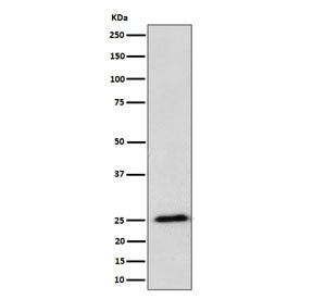Western blot testing of human HeLa cell lysate with RPL10A antibody. Predicted molecular weight ~25 kDa.