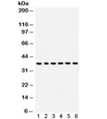 Western blot test of 1) rat brain, 2) human HepG2, 3) (h) SMMC, 4) (h) U87, 5) (h) placenta, 6) (h) HeLa lysate with STRAP antibody. Predicted/observed molecular weight ~38 kDa.