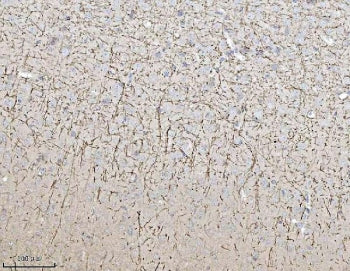 IHC staining of FFPE mouse brain tissue with MAG antibody. HIER: boil tissue sections in pH8 EDTA for 20 min and allow to cool before testing.