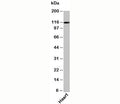 Western blot testing of human samples with Exportin 4 antibody at 1ug/ml.