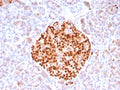 IHC staining of FFPE human pancreas tissue with PAX6 antibody (clone PAX6/8578R). HIER: boil tissue sections in pH 9 10mM Tris with 1mM EDTA for 20 min and allow to cool before testing.