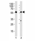 Western blot analysis of (1) HL-60 and (2) U251 MG cell line using p65 antibody at 1:1000.