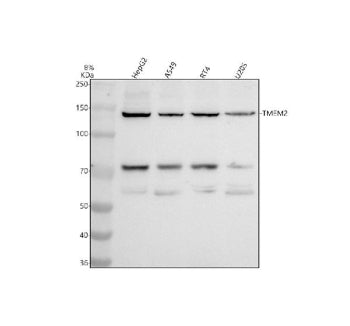 Western blot analysis of CEMIP2 using anti-CEMIP2 antibody. Electrophoresis was performed on a 8% SDS-PAGE gel at 80V (Stacking gel) / 120V (Resolving gel) for 2 hours. Lane 1: human HepG2 whole cell lysates, Lane 2: human whole cell lysates, Lane 3: human RT4 whole cell lysates, Lane 4: human U2OS whole cell lysates. After electrophoresis, proteins were transferred to a nitrocellulose membrane at 150 mA for 50-90 min. Blocked the membrane with 5% non-fat milk/TBS for 1.5 hour at RT.