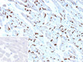 IHC staining of FFPE human heart tissue with Cadherin 2 antibody (clone CDH2/9493). Inset: PBS used in place of primary Ab (secondary Ab negative control). HIER: boil tissue sections in pH 9 10mM Tris with 1mM EDTA for 20 min and allow to cool before testing.