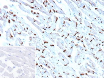 IHC staining of FFPE human heart tissue with Cadherin 2 antibody (clone CDH2/9493). Inset: PBS used in place of primary Ab (secondary Ab negative control). HIER: boil tissue sections in pH 9 10mM Tris with 1mM EDTA for 20 min and allow to cool before testing.