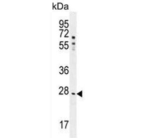 Western blot testing of human HepG2 cell lysate with NR0B2 antibody. Predicted molecular weight ~28 kDa.