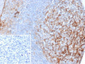 IHC staining of FFPE human tonsil tissue with ICAM-1 antibody (clone ICAM1/6606). Inset: PBS used in place of primary Ab (secondary Ab negative control). HIER: boil tissue sections in pH 9 10mM Tris with 1mM EDTA for 20 min and allow to cool before testing.