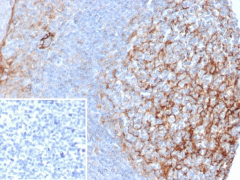 IHC staining of FFPE human tonsil tissue with ICAM-1 antibody (clone ICAM1/6606). Inset: PBS used in place of primary Ab (secondary Ab negative control). HIER: boil tissue sections in pH 9 10mM Tris with 1mM EDTA for 20 min and allow to cool before testing.