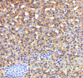 IHC staining of FFPE zebrafish liver tissue with Zebrafish Lysozyme antibody, HRP-labeled secondary and DAB substrate. HIER: boil tissue sections in pH8 EDTA for 20 min and allow to cool before testing.