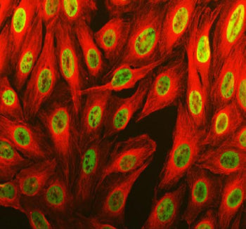 Immunofluorescent staining of THRAP3 using anti-THRAP3 antibody (green) and anti-Alpha Tubulin antibody (red). THRAP3 was detected in an immunocytochemical section of U2OS cells. Enzyme antigen retrieval was performed using IHC enzyme antigen retrieval reagent for 15 mins. The cells were blocked with 10% goat serum. And then incubated with 5 ug/ml rabbit anti-THRAP3 antibody and mouse anti-Beta Tubulin antibody overnight at 4oC.