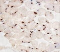 IHC testing of FFPE human skeletal muscle tissue with PPARA antibody. HIER: steam section in pH6 citrate buffer for 20 min and allow to cool prior to staining.