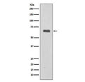Western blot testing of human fetal liver lysate with C9 antibody. Expected molecular weight: 63-70 kDa depending on the level of glycosylation.