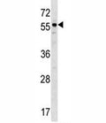 BMP3 antibody western blot analysis in ZR-75-1 lysate. Predicted molecular weight: 55 kDa.