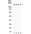 Western blot testing of human 1) 293, 2) SW620, 3) COLO320 and 4) HeLa cell lysate with HKDC1 antibody. Expected molecular weight: ~103 kDa, observed here at ~170 kDa.