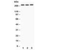 Western blot testing of NOTCH4 antibody and Lane 1: A549; 2: SMMC-7721; 3: HeLa. Predicted size: 210KD
