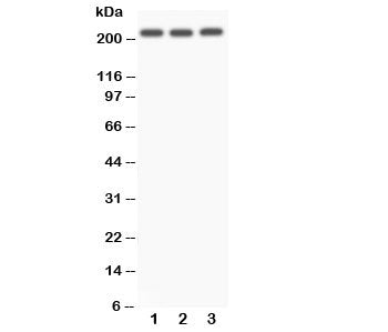 Western blot testing of NOTCH4 antibody and Lane 1: A549; 2: SMMC-7721; 3: HeLa. Predicted size: 210KD