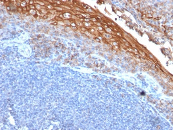 IHC testing of FFPE human tonsil with CD146 antibody (clone rMUC18/1130). Required boiling tissue sections in 10mM Tris with 1mM EDTA, pH8, for 10-20 min followed by cooling at RT for 20 min.