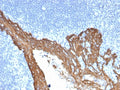 IHC staining of FFPE human prostate with Cytokeratin 8 antibody (clone KRT8/2115). HIER: boil tissue sections in pH 9 10mM Tris with 1mM EDTA for 20 min and allow to cool before testing.