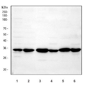 Western blot testing of 1) human U-87 MG, 2) human U-251, 3) rat brain, 4) rat C6, 5) mouse brain and 6) mouse Neuro-2a cell lysate using APH1A antibody. Expected molecular weight: 27~29 kDa.