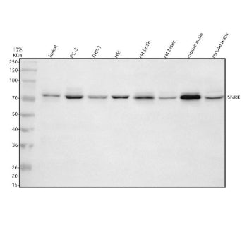 Western blot analysis of SNRK using anti-SNRK antibody. Electrophoresis was performed on a 10% SDS-PAGE gel at 80V (Stacking gel) / 120V (Resolving gel) for 2 hours. Lane 1: human Jurkat whole cell lysates, Lane 2: human PC-3 whole cell lysates, Lane 3: human THP-1 whole cell lysates, Lane 4: human HEL whole cell lysates, Lane 5: rat brain tissue lysates, Lane 6: rat testis tissue lysates, Lane 7: mouse brain tissue lysates, Lane 8: mouse testis tissue lysates.