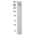 Western blot testing of ABCA4 antibody and mouse eye tissue lysate. Predicted molecular weight ~256 kDa but may be observed at higher molecular weights due to glycosylation.