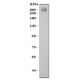 Western blot testing of ABCA4 antibody and mouse eye tissue lysate. Predicted molecular weight ~256 kDa but may be observed at higher molecular weights due to glycosylation.