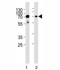 Western blot analysis of lysate from human 1) HeLa, and 2) Jurkat cell line using PAK3 antibody at 1:1000. Expected molecular weight ~62 kDa.