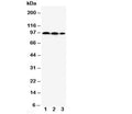 Western blot testing of HIF2a antibody and Lane 1: HeLa; 2: MCF-7; 3: Jurkat cell lysate