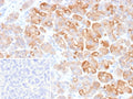 IHC staining of FFPE human pancreas tissue with CLPS antibody (clone CLPS/9902). Inset: PBS used in place of primary Ab (secondary Ab negative control). HIER: boil tissue sections in pH 9 10mM Tris with 1mM EDTA for 20 min and allow to cool before testing.