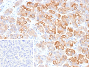 IHC staining of FFPE human pancreas tissue with CLPS antibody (clone CLPS/9902). Inset: PBS used in place of primary Ab (secondary Ab negative control). HIER: boil tissue sections in pH 9 10mM Tris with 1mM EDTA for 20 min and allow to cool before testing.