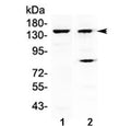 Western blot testing of 1) mouse liver and 2) human A431 lysate with FBXL11 antibody at 0.5ug/ml. Predicted molecular weight ~133 kDa.