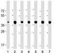 Western blot testing of TOMM40 antibody at 1:2000: Lane 1) human brain, 2) HEK293, 3) U-87 MG, 4) Hut78, 5) HeLa, 6) A431 and 7) HepG2 cell lysate. Predicted molecular weight ~37 kDa.