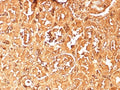 IHC staining of FFPE human kidney tissue with recombinant HBAa antibody (clone rHBA/9167). HIER: boil tissue sections in pH 9 10mM Tris with 1mM EDTA for 20 min and allow to cool before testing.