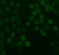 IF analysis of UBE2T using anti-UBE2T antibody (green). UBE2T was detected in an immunocytochemical section of MCF-7 cells. Enzyme antigen retrieval was performed using IHC enzyme antigen retrieval reagent for 15 mins. The cells were blocked with 10% goat serum. And then incubated with 1:100 rabbit anti-UBE2T antibody overnight at 4oC. DyLight 488 Conjugated Goat Anti-Rabbit IgG was used as secondary antibody at 1:500 dilution and incubated for 30 min at 37oC.