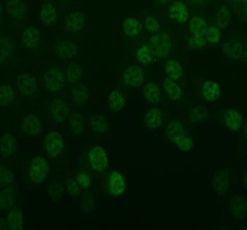 IF analysis of UBE2T using anti-UBE2T antibody (green). UBE2T was detected in an immunocytochemical section of MCF-7 cells. Enzyme antigen retrieval was performed using IHC enzyme antigen retrieval reagent for 15 mins. The cells were blocked with 10% goat serum. And then incubated with 1:100 rabbit anti-UBE2T antibody overnight at 4oC. DyLight 488 Conjugated Goat Anti-Rabbit IgG was used as secondary antibody at 1:500 dilution and incubated for 30 min at 37oC.