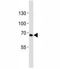 Western blot analysis of lysate from HeLa cell line using CD30 antibody diluted at 1:1000. Predicted molecular weight: 53-120 kDa depending on glycosylation level.