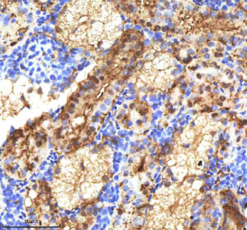 IHC staining of FFPE zebrafish kidney tissue with Etv2 antibody, HRP-labeled secondary and DAB substrate. HIER: boil tissue sections in pH8 EDTA for 20 min and allow to cool before testing.
