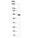 Western blot testing of mouse thymus lysate with GPI antibody at 0.5ug/ml. Predicted/observed molecular weight: ~64 kDa.