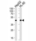 Western blot analysis of lysate from HepG2, HL-60 cell line (left to right) using beta-Actin antibody at 1:1000 for each lane.